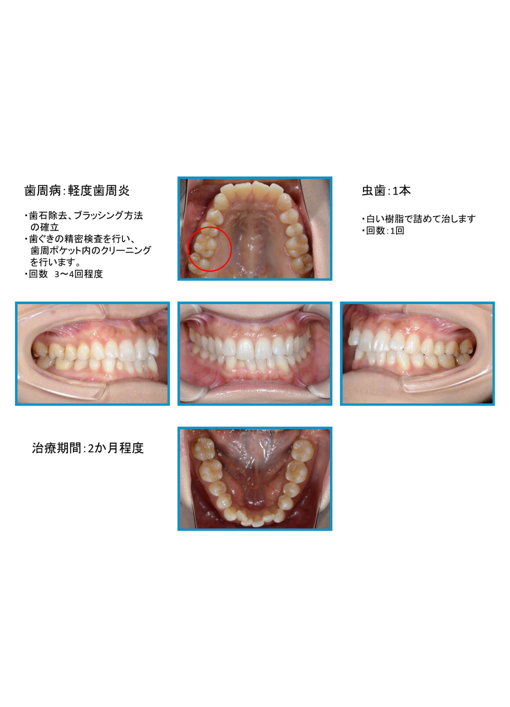 口腔写真・診断結果