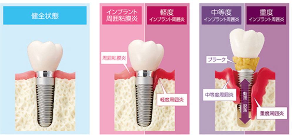 定期メインテナンス・アフターケア