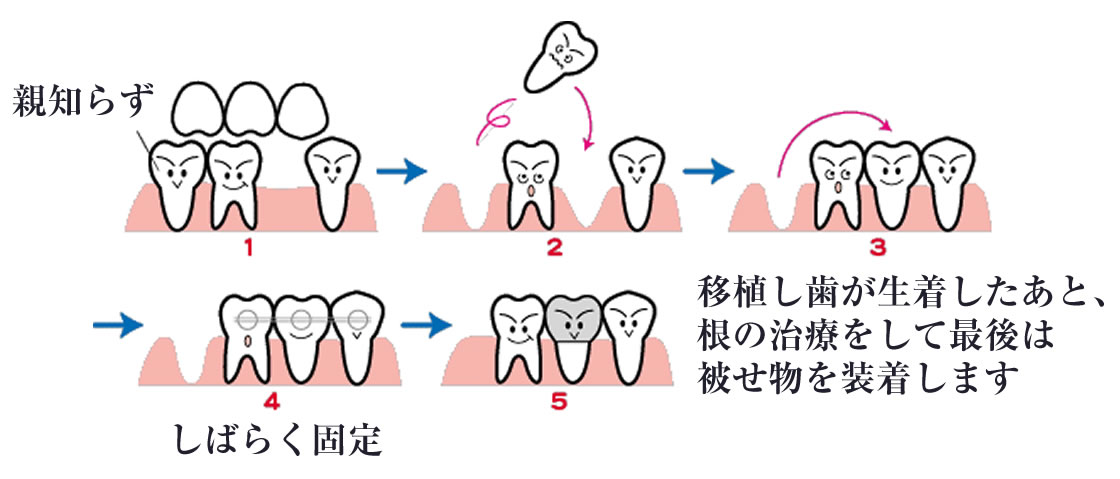 将来的な移植の可能性